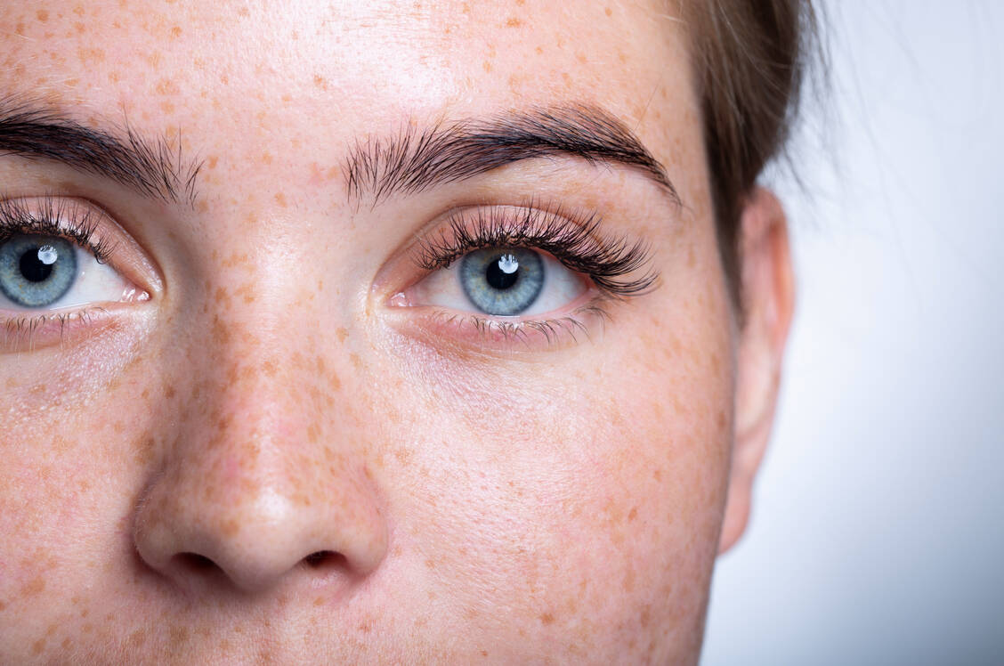 Schönheitstrend, der ins Auge gehen kann: Prostaglandin-haltige Wimpernseren können schwere Nebenwirkungen am Auge verursachen. / © Getty Images/Riakhin Anton