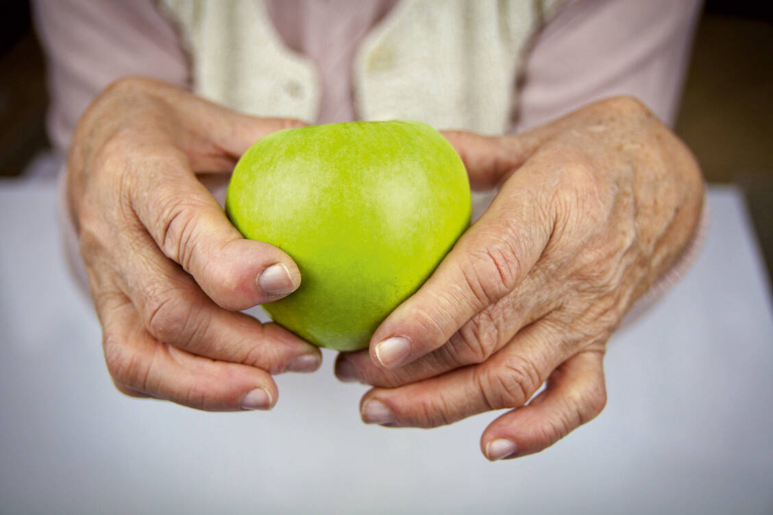 Der rechtzeitige Einsatz moderner Medikamente gegen rheumatoide Arthritis hilft, Verformungen der Gelenke zu verhindern. / Foto: Fotolia/hriana