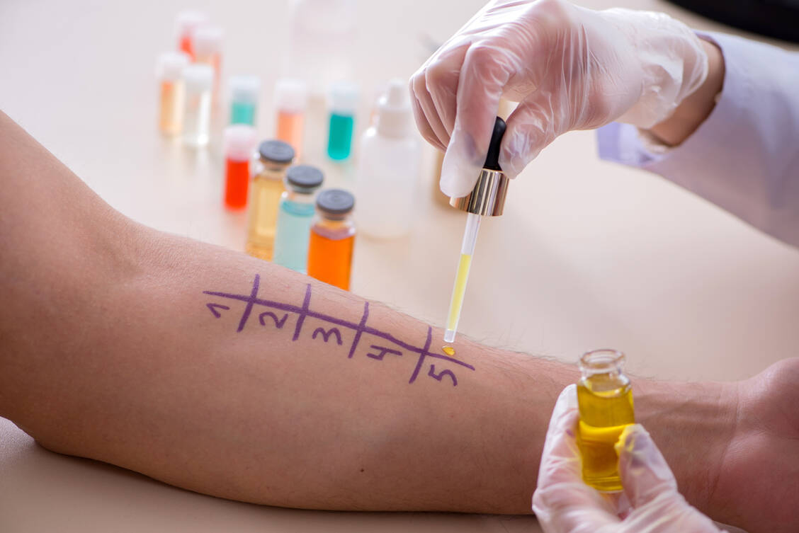 Vor allem bei Kindern sollte einem Verdacht auf eine Arzneimittelallergie immer eine allergologische Abklärung folgen. / Foto: Shutterstock/Elnur