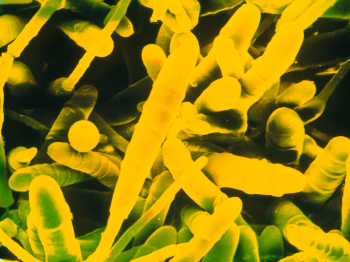Trichophyton rubrum ist in 80 Prozent der Fälle der Auslöser für Nagelpilz. / Foto: Science Photo Library / Gueho, E.