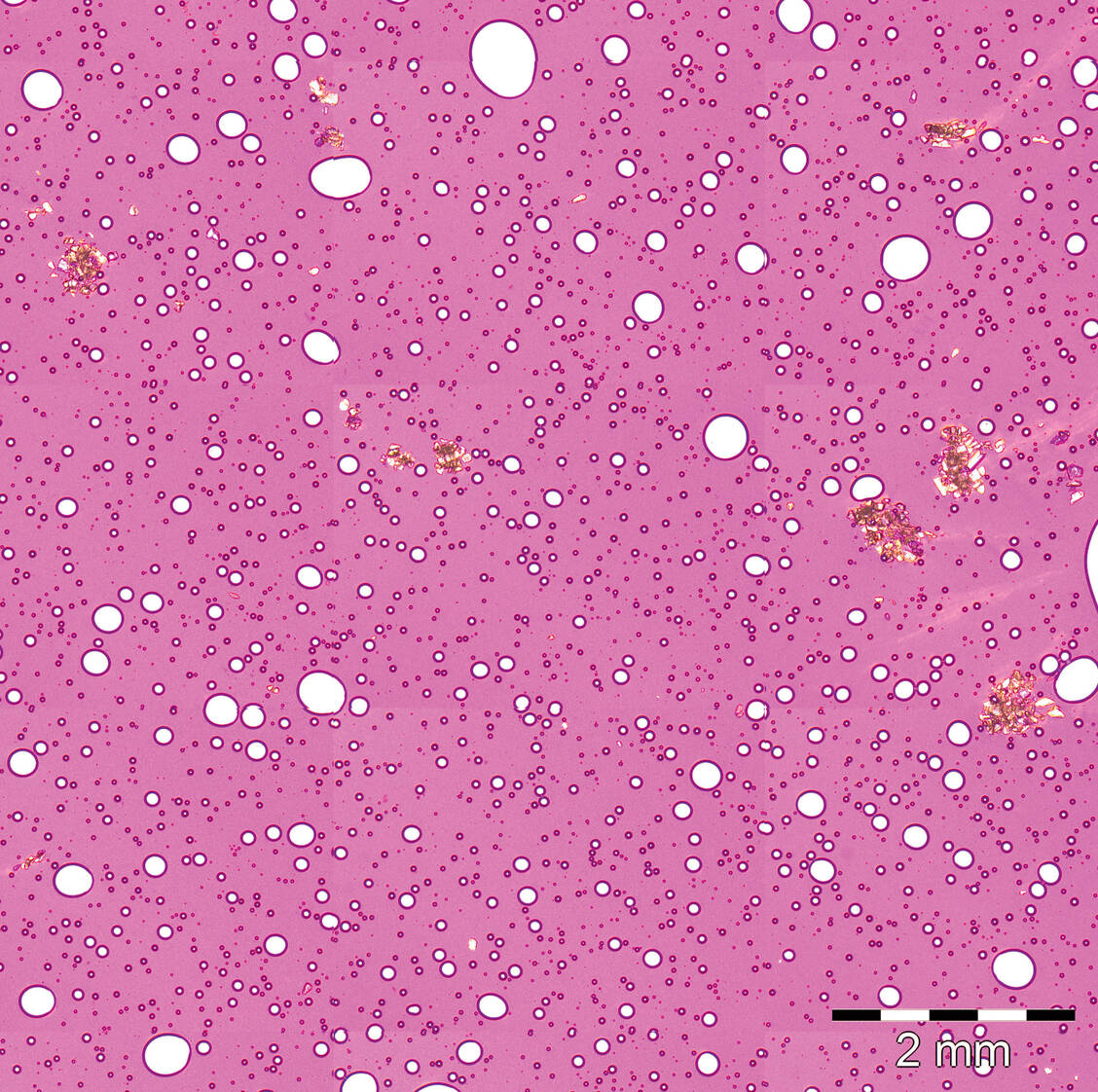 Metronidazol-Kristalle in der mikroskopischen Untersuchung / Foto: ZL