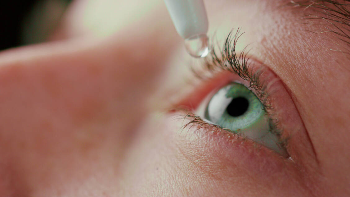 Kontinuierlich angewendet können Tränenersatzmittel bei trockenen Augen die Beschwerden lindern. / © Adobe Stock/mputsylo