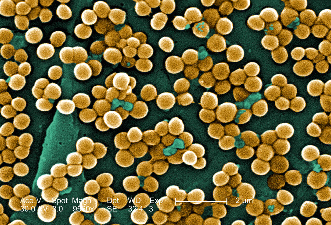Bakterien und seine Gifte am Werk: Und das kann durchaus auch positive Aspekte haben, haben Forscher aus Jena für Staphylococcus aureus herausgefunden. / Foto: CDC