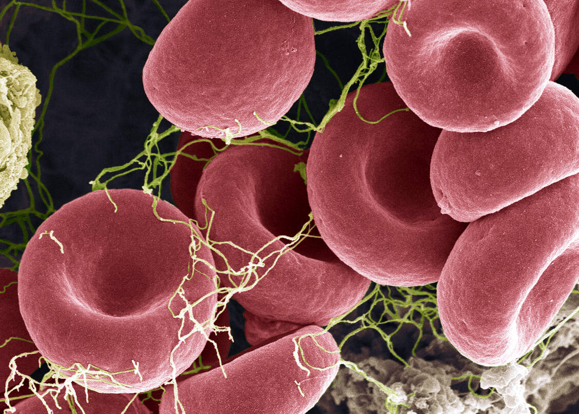 Welche Tipps sollten Menschen, die einen Blutverdünner nehmen und kurz vor der Covid-19-Impfung stehen, berücksichtigen? / Foto: Getty Images/Science Photo Library - STEVE GSCHMEISSNER.