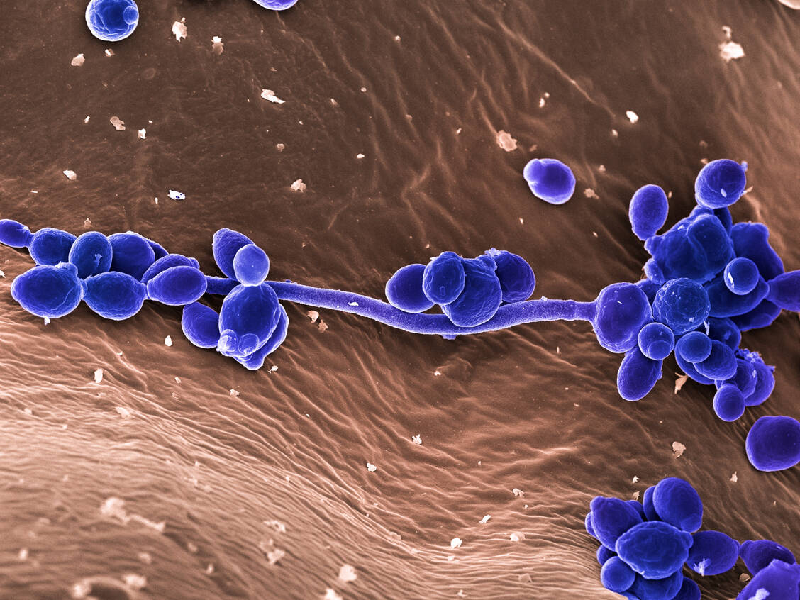 Was in der Vagina für heftigen Juckreiz sorgt, ist unter dem Rasterelektronenmikroskop fast hübsch anzuschauen: Candida albicans auf Vaginalepithelzellen. / Foto: Science Photo Library / Flegler, Dr. Stanley / Visual Unlimited