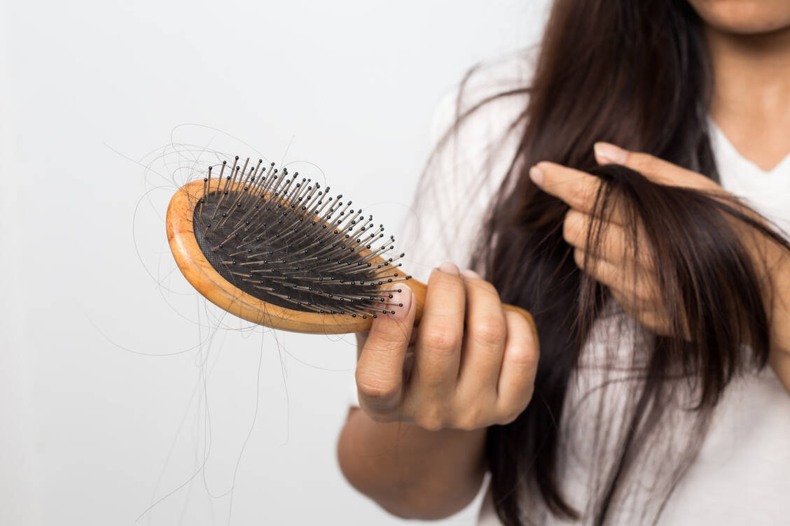 Bei einem Eisenmangel kann es zu Haarausfall kommen. / Foto: Adobe Stock/suriya