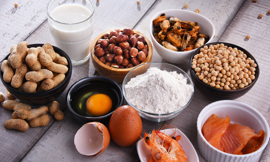 Typische Allergene: Kuhmilch, Erd-und Haselnüsse, Ei, Weizen, Soja und Fisch lösen vor allem bei Kindern häufig allergische Hautsymptome aus. / Foto: Getty Images/monticelllo