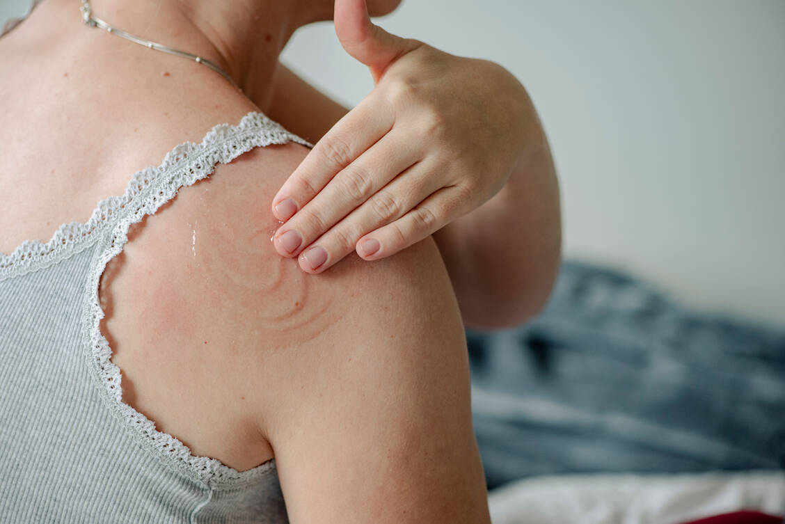 Verglichen mit Tibolon und oralen Estrogen(-Gestagen-)Präparaten zeigten sich transdermale HRT-Formen als vergleichsweise risikoarme Option. / © Getty Images/Emilija Manevska