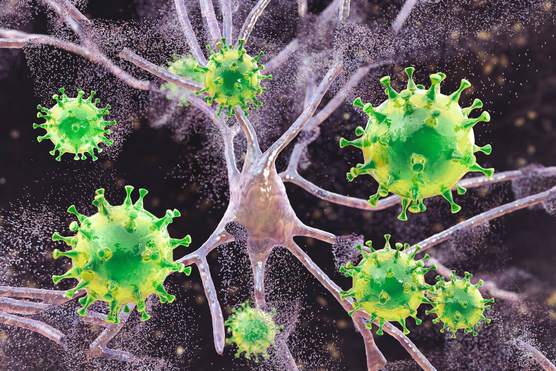 Zwischen viral-bedingter Gehirnentzündung und Alzheimer fanden die Forschenden den stärksten Zusammenhang / Foto: Getty Images/KATERYNA KON/SCIENCE PHOTO LIBRARY