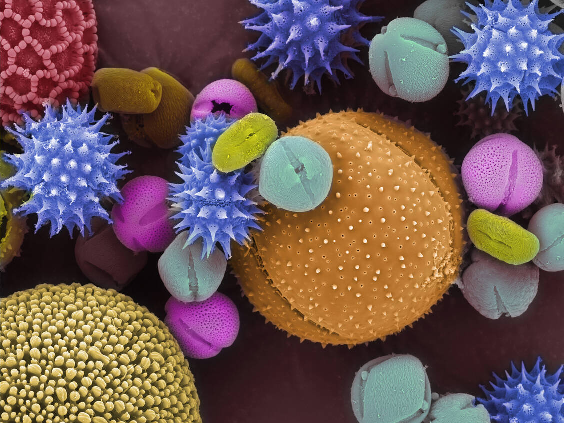 Unter dem Elektronenmikroskop eigentlich ganz hübsch anzusehen: Pollen. Doch sie scheinen weit mehr als nur Allergien auslösen zu können. / Foto: Getty Images/Kallista Images (Scott Camazine)