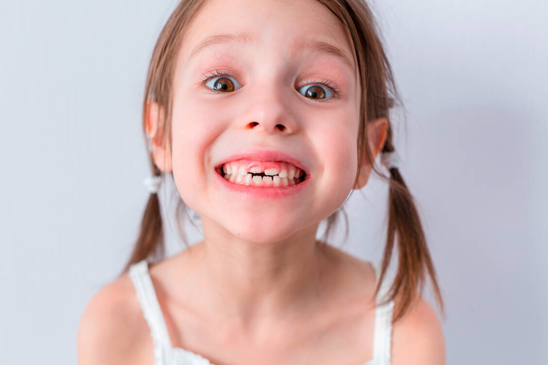 Gut aufpassen auch schon auf die Milchzähne – das ist am wichtigsten, um später mit gesunden Zähnen durchs Leben gehen zu können. / Foto: Adobe Stock/azamyatina