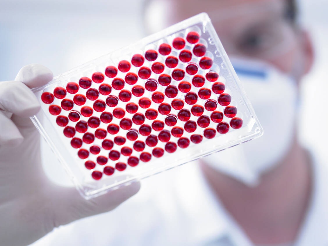 Bei bestimmten Medikamenten müssen Ärzte das Blut regelmäßig testen, um Nebenwirkungen schnell auf die Schliche zu kommen. / Foto: Getty Images/
Adam Gault