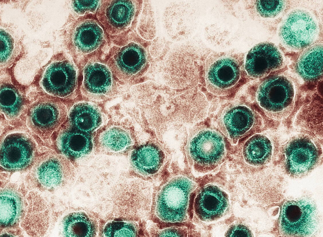 Herpesviren unter dem Elektronenmikroskop – die Viren verbleiben nach einer Infektion lebenslang im Körper. / Foto: Getty Images/Callista Images