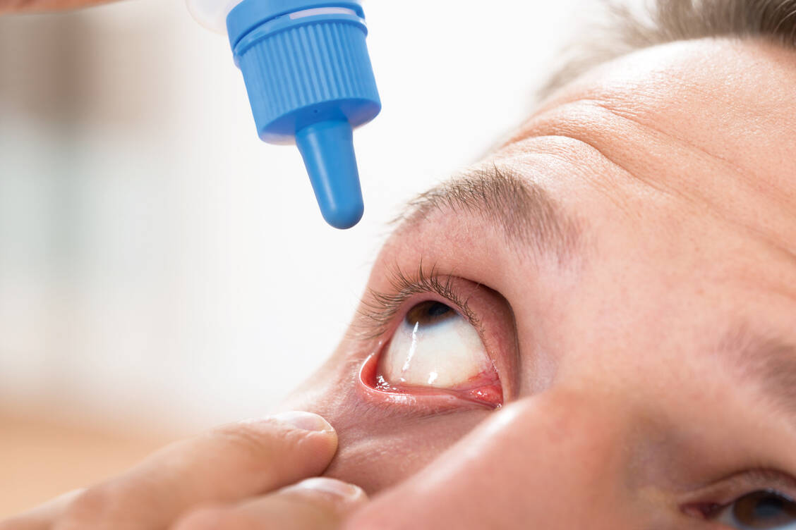 Augentropfen werden mit Wasser für Injektionszwecke hergestellt. / Foto: Shutterstock/Andrey Popov