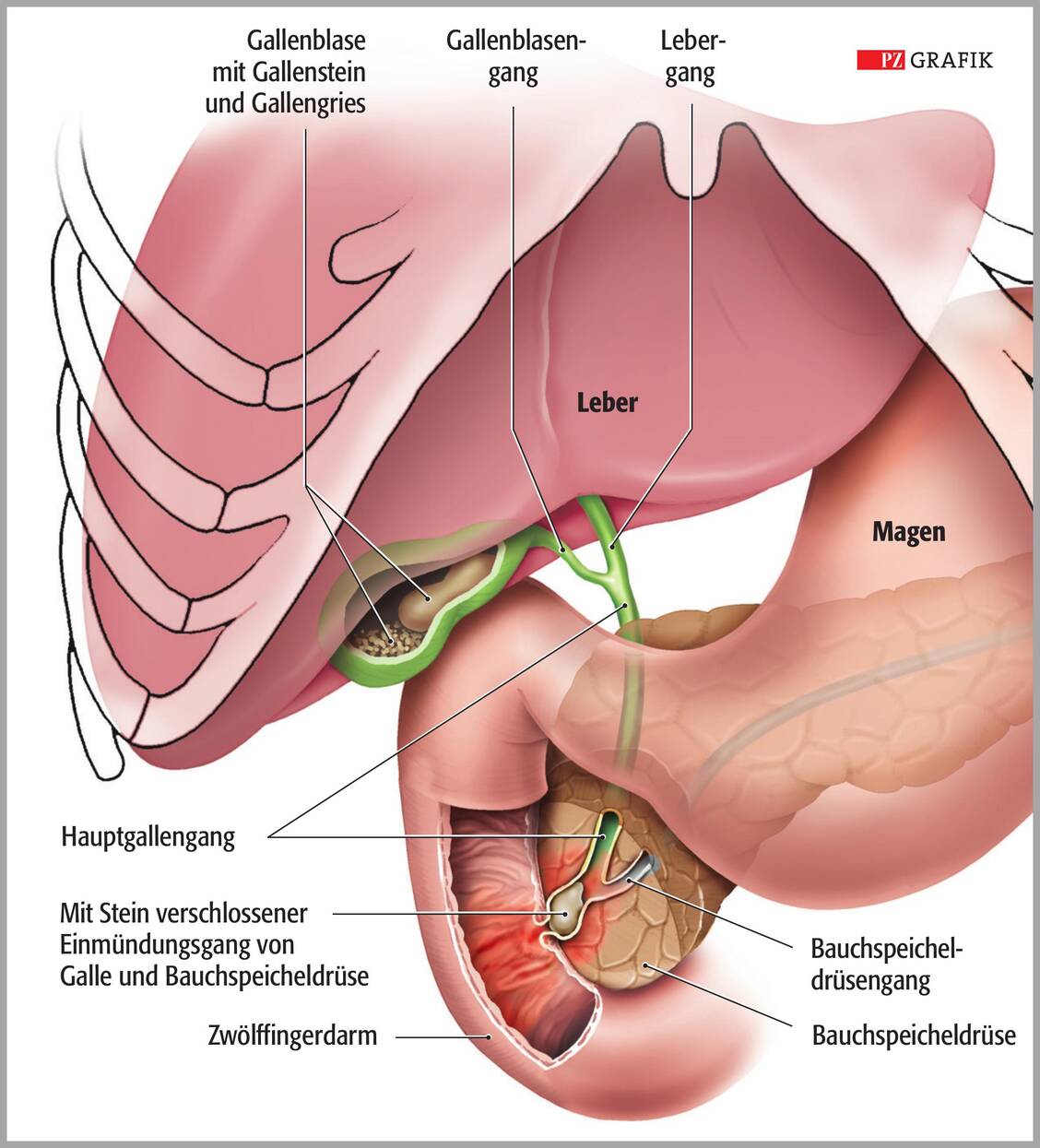 Anatomie der Galle mit intra- und extrahepatischen Gallengängen / © PZ/Stephan Spitzer