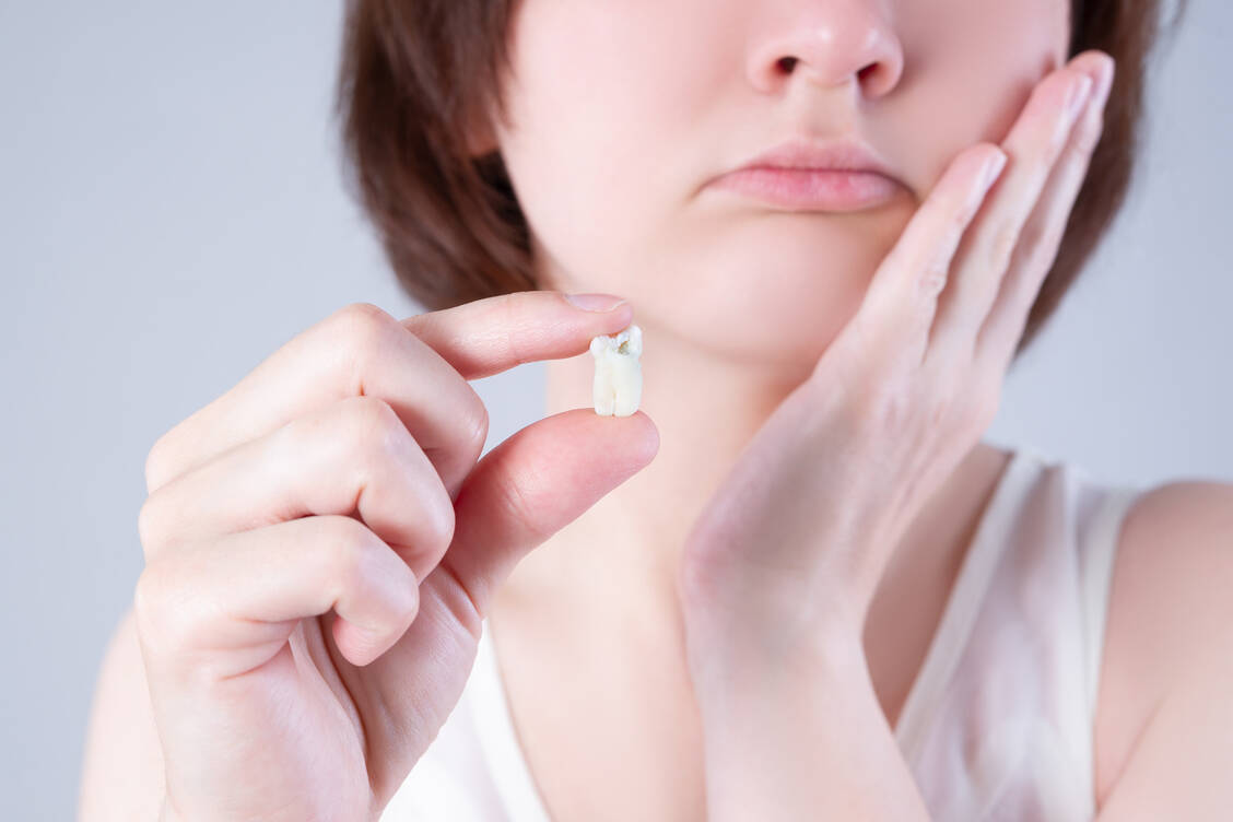 Die Heilung nach Entfernung der Weisheitszähne kann schmerzhaft sein. Mit der Ernährung können Patienten die Wundheilung unterstützen. / Foto: Adobe Stock/staras