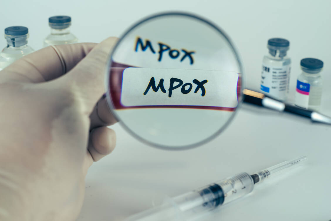 Samenflüssigkeit kann die Aufnahme von Mpox-Viren in menschliche Zellen fördern und so eine Infektion begünstigen. / © Adobe Stock/Jun Li
