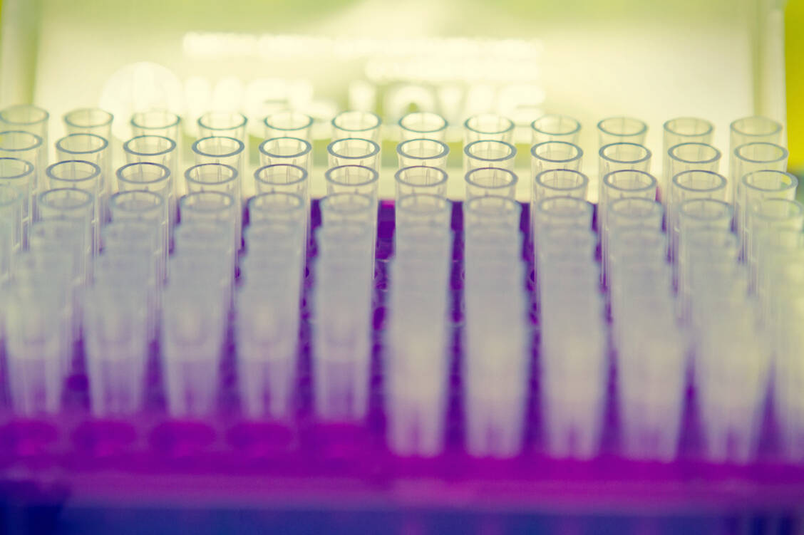 Wissenschaftler legen ihren Fokus aktuell besonders darauf, Behandlungsmöglichkeiten für die beiden komplizierten Virustypen B und D zu finden. / Foto: Getty Images/JVisentin