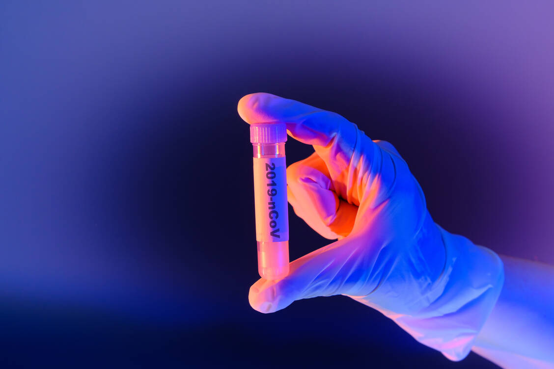 Das SARS-CoV-2-Virus ist nur eines der Viren, dessen Folgen für den Organismus deutlich über die akute Erkrankung hinausgehen können. / Foto: Adobe Stock/Guntar Feldmann