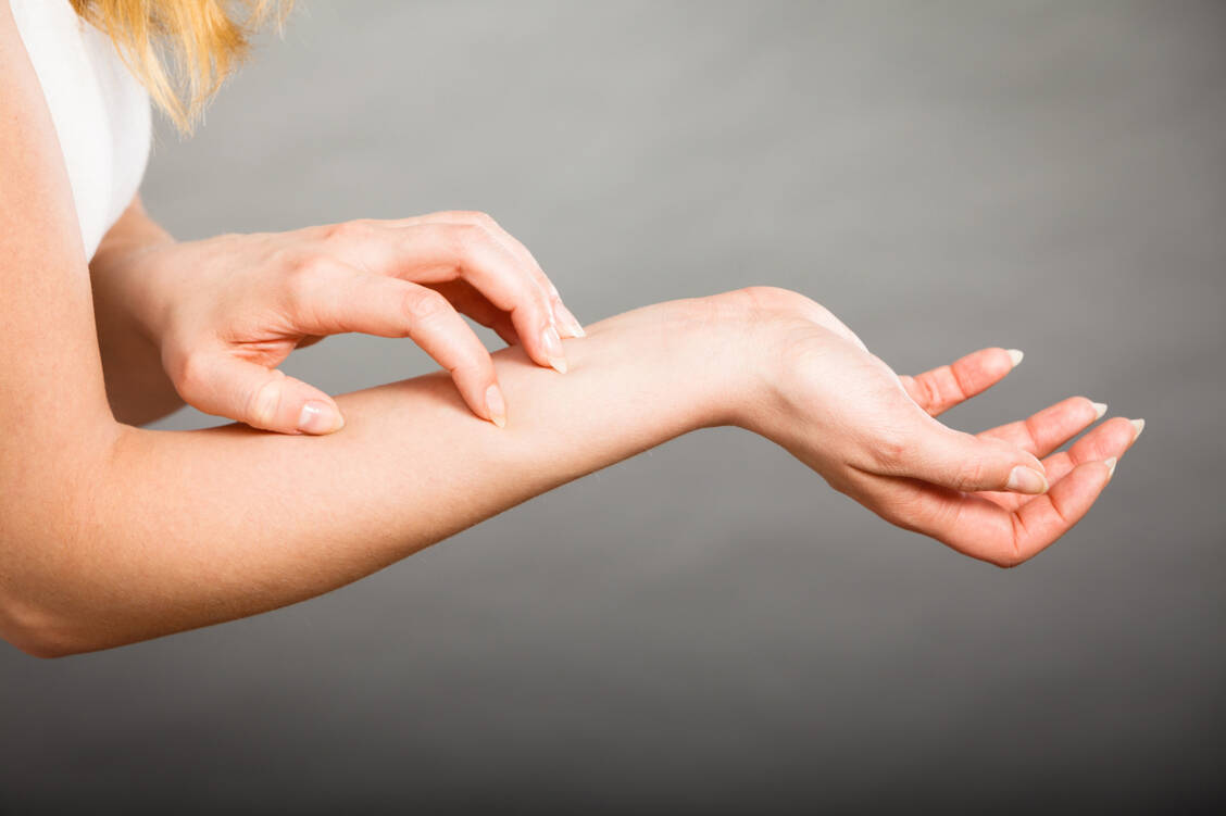 Bei den meisten Menschen mit Urtikaria reagiert das Immunsystem überempfindlich. / Foto: Fotolia/anetlanda