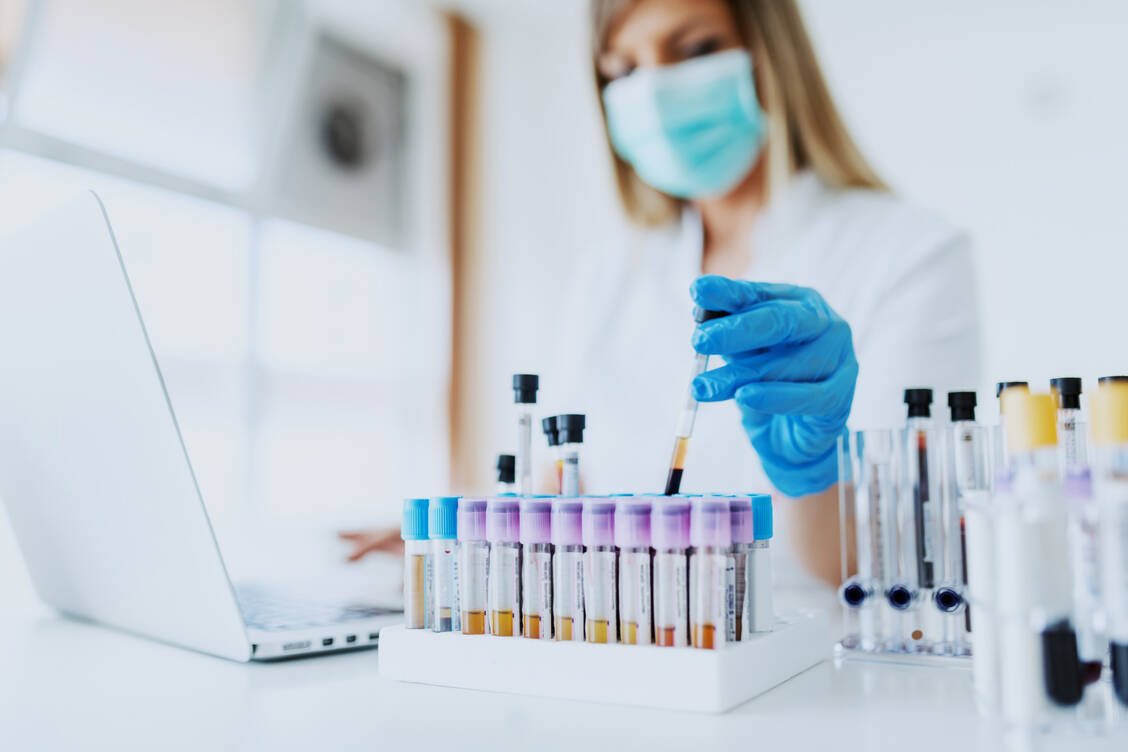 Der immunologische iFOBT-Stuhltest ist  zuverlässiger und weniger störanfällig als der Guajak-Test, wird aber nur selten genutzt.  / Foto: Adobe Stock/dusanpetkovic1