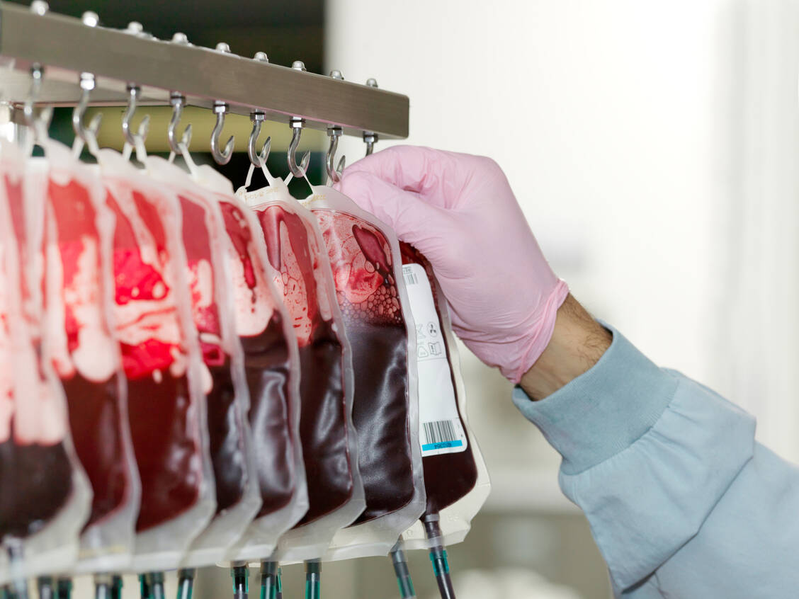 Spenderblut wird heute routinemäßig auf verschiedene Erreger getestet. UV-Licht-basierte Verfahren könnten die Sicherheit von Blutkonzentraten zusätzlich verbessern. / Foto: Getty Images/Elke Meitzel