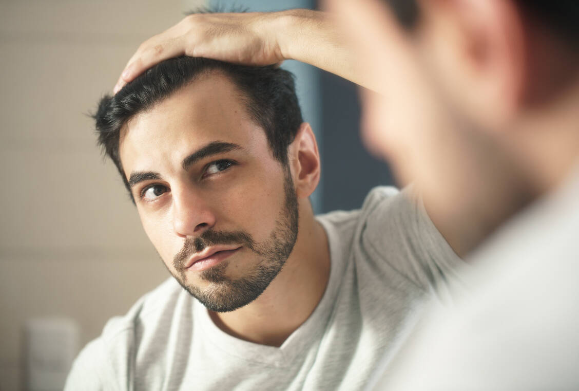 Nicht nur Frauen empfinden es als belastend, wenn die Haarpracht weicht. / Foto: Fotolia/diego cervo