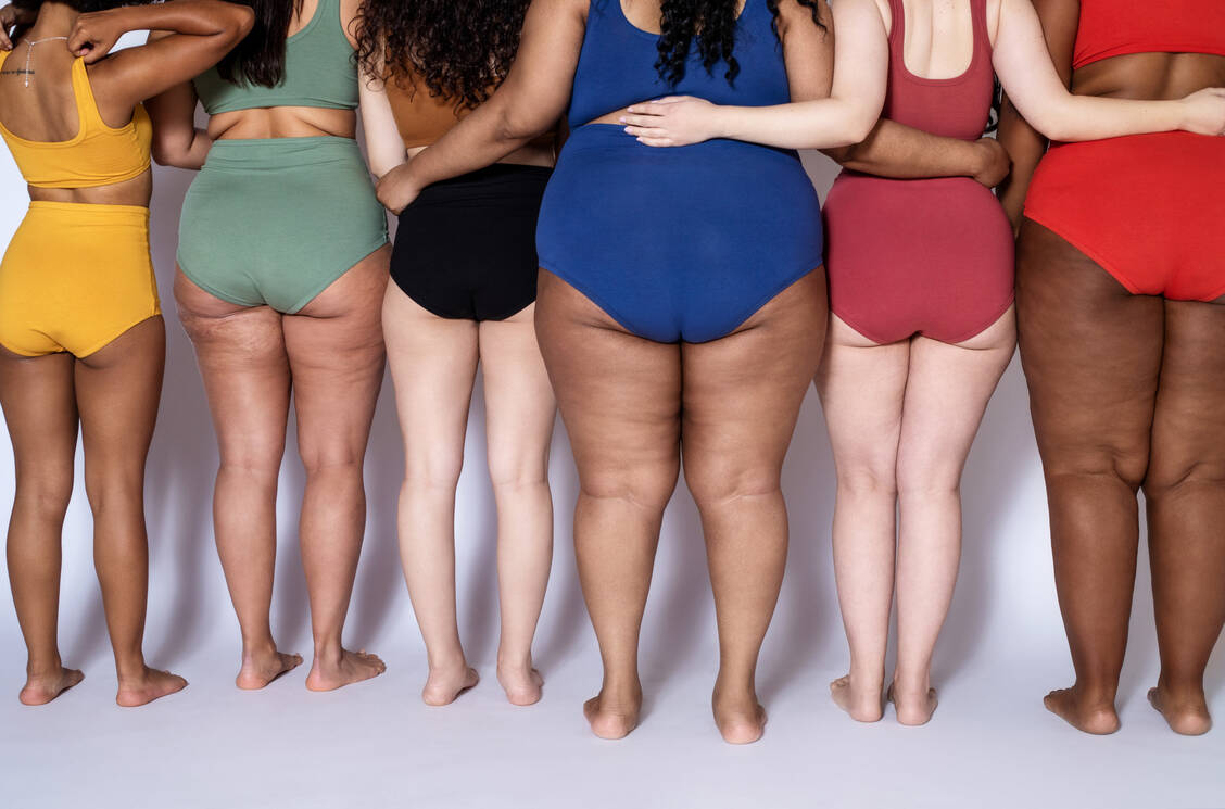 Dellen an Po und Schenkeln haben mit Faulheit, Unsportlichkeit oder schlechtem Lebensstil nichts zu tun: Cellulite ist Veranlagung und völlig normal.  / Foto: Getty Images/Luis Alvarez