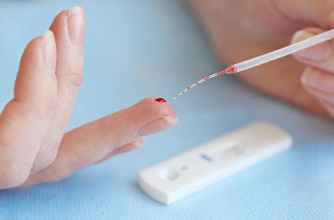 Therapieziel bei einer chronischen HBV-Infektion ist es, das Virus dauerhaft unter die Kontrolle des Immunsystems zu bringen. / Foto: Adobe Stock/Africa Studio