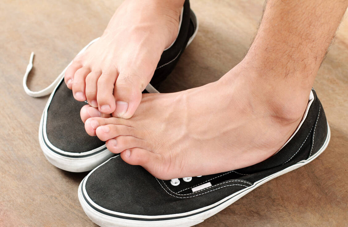 Sportler laufen besonders häufig mit Fußpilz herum; so erklärt sich auch die englische Bezeichnung »athlete´s foot für diese Art der Mykose.  / Foto: Adobe Stock/maska82