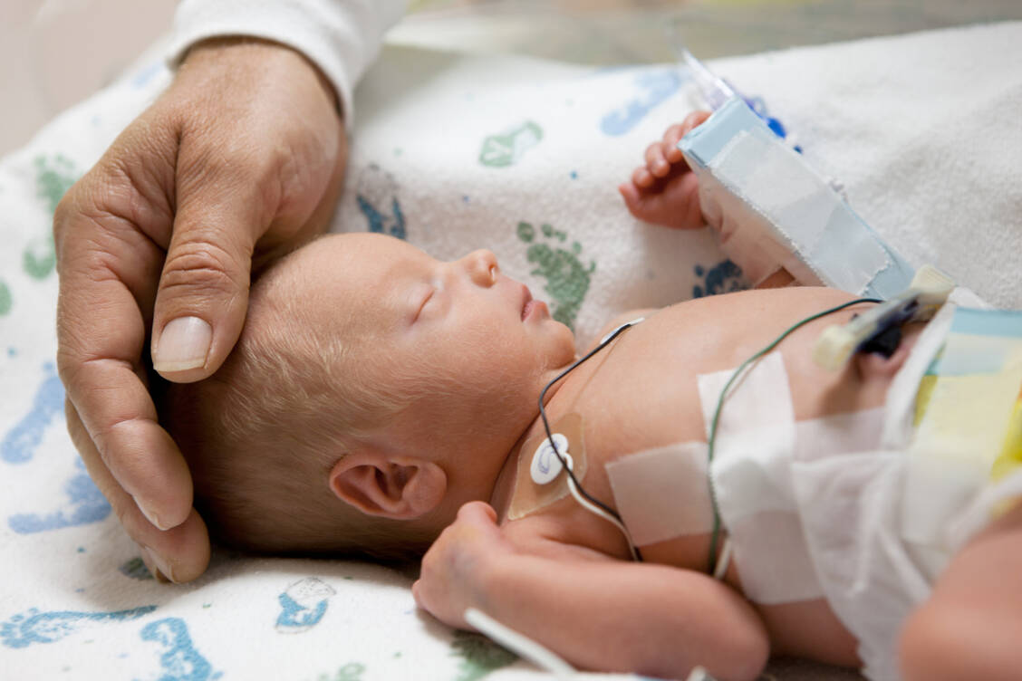 Kinder, die vor der vollendeten 37. Schwangerschaftswoche geboren werden, gelten als Frühgeburt. Je länger sie im Mutterleib waren, desto besser ihre Chancen. / Foto: Getty Images/cdwheatley