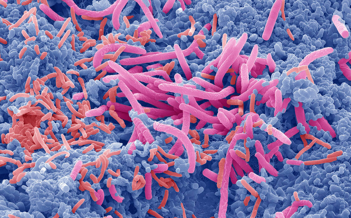 Patienten, die unter Long-Covid-Beschwerden litten, hatten im Rahmen einer Studie eine andere Mikrobiom-Zusammensetzung in Mund und Atemwegen als Patienten ohne Long-Covid-Beschwerden. / © Getty Images/STEVE GSCHMEISSNER/SCIENCE PHOTO LIBRARY