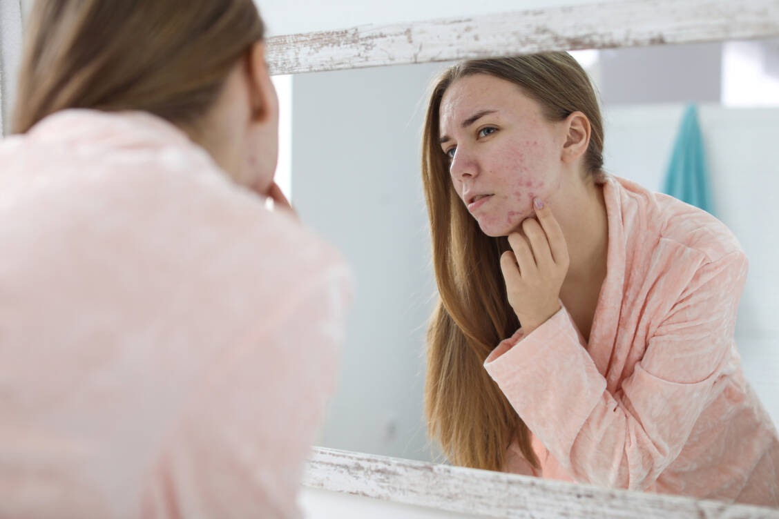 To keep the skin moist, it is best to use light gels or day creams that do not leave an oily film or residue on the skin. / Foto: Adobe Stock/New Africa