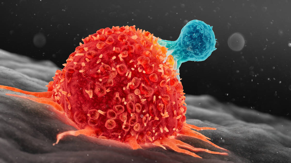 Bei der CAR-T-Zelltherapie werden T-Lymphozyten mit chimären Antigen-Rezeptoren (CAR) ausgestattet – diese dienen als eine Art Fühler für Krebszellen. / © Getty Images/Science Photo Library/Thom Leach