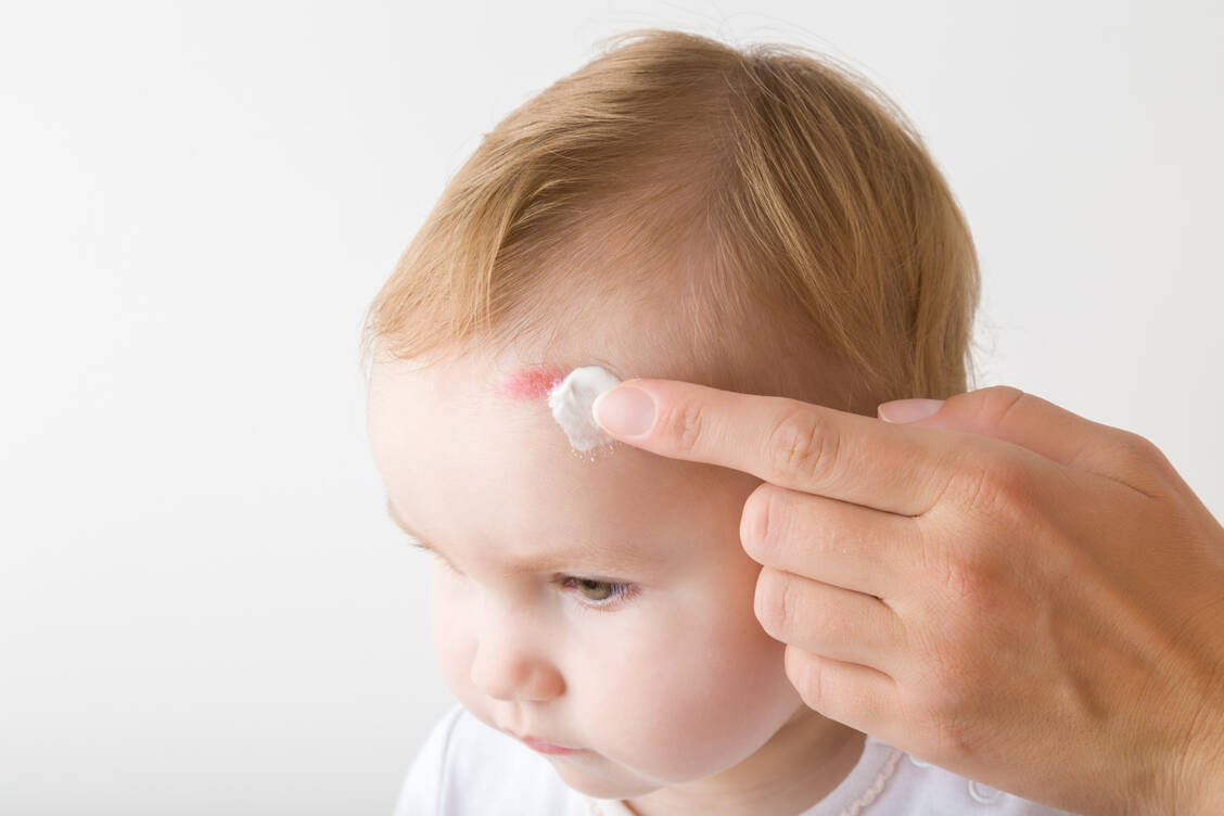 Mit dem Wirkstoff Dexpanthenol können auch schon die Wunden kleiner Entdecker behandelt werden. / Foto: Getty Images/FotoDuets
