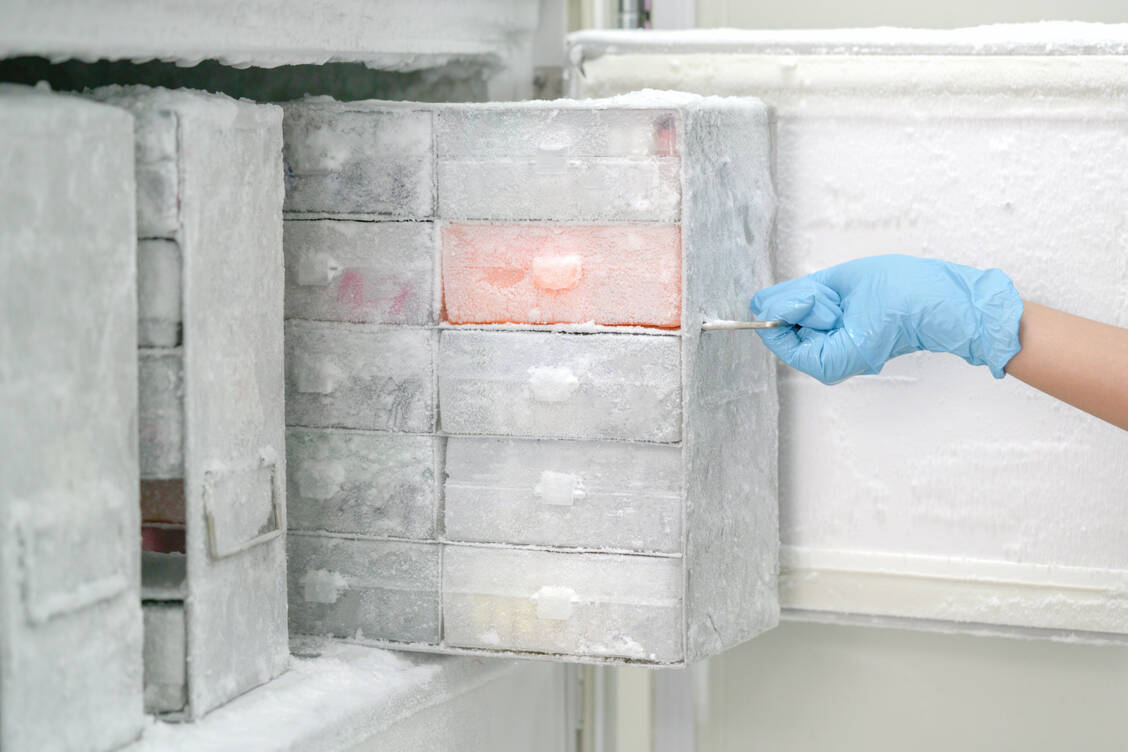 Für die Datenbanken werden Darmbakterien bei minus 80 Grad eingefroren. / Foto:  (Symbolbild) Getty Images/Science Photo Library
