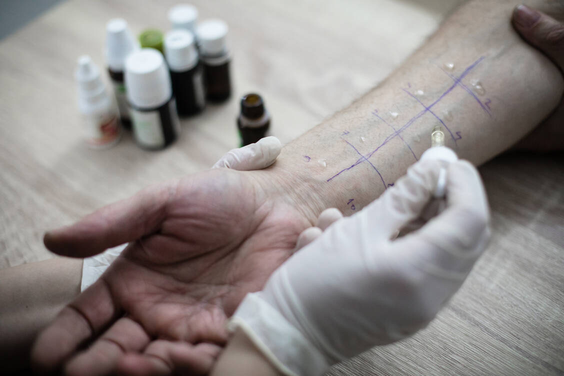 Bei einem Pricktest bekommt ein Allergiker standardisierte Allergenlösungen auf die Innenseite des Unterarms getropft, dann wird die Hautstelle mit einer feinen Nadel vorsichtig eingestochen. Anschließend wird beobachtet, ob eine Hautreaktion auftritt. / © Getty Images/DusanManic