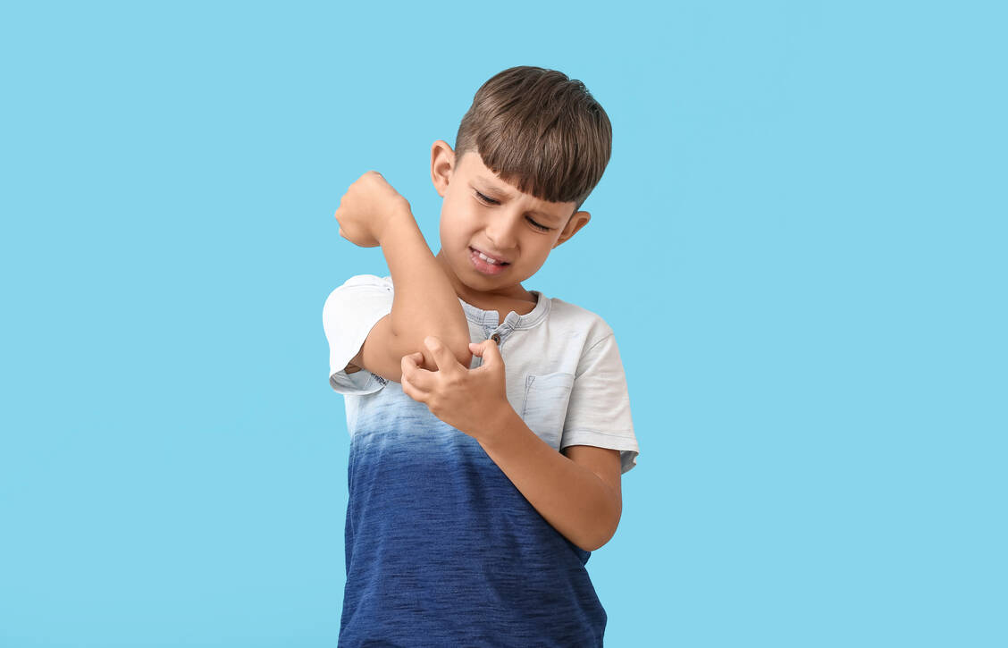 Wenn es juckt, hat die Mücke schon zugestochen – und das Mückenspray versagt. Gegen das Jucken kann dann möglicherweise noch ein Stichheiler helfen. / © Adobe Stock/Pixel-Shot