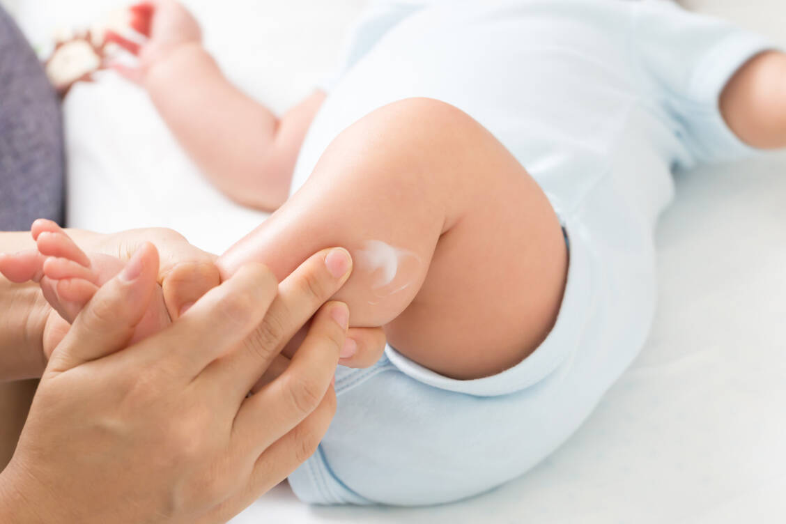 Eine frühzeitige Cortisontherapie könnte das Risiko für eine Nahrungsmittelallergie im späteren Leben senken. / Foto: Adobe Stock/comzeal