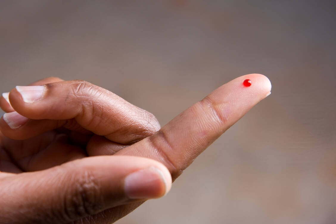 Apotheken beschäftigen sich täglich mit dem Thema Blut. / © Getty Images/MarkHatfield
