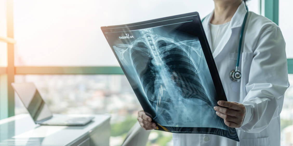 Unter Laborbedingungen konnte das Omikron-Pseudovirus Lungenzellen schlechter infizieren als das Delta-Pseudovirus. Es ist jedoch unklar, inwieweit das auf das reale Leben übertragbar ist. / Foto: Adobe Stock/Chinnapong