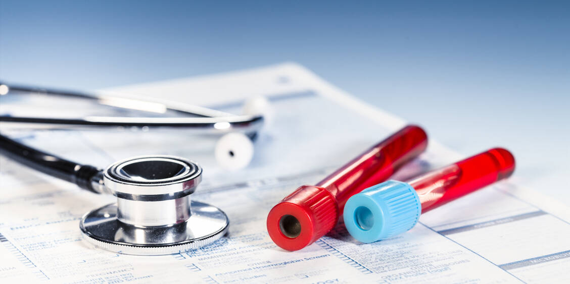In Zukunft kann ein neuer Antikörpertest möglicherweise bei der Therapie-Verlaufskontrolle von HPV16-bedingten Kopf-Halstumoren helfen.  / Foto: Adobe Stock/luchschen