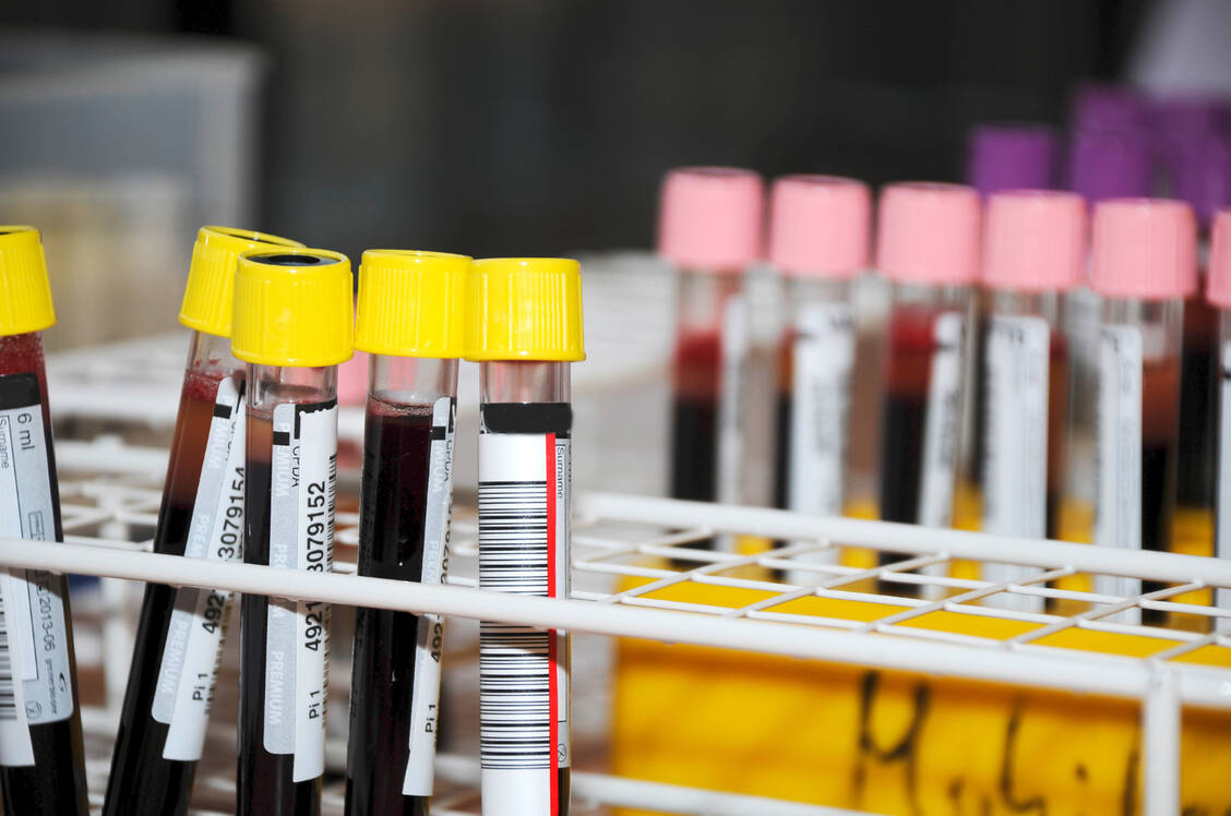 In a small blood count, the doctor counts the platelets (PLT or THRO), erythrocytes (RBC or ERY) and leucocytes (WBC or LEUK). Platelets, also known as thrombocytes, play an important role in blood clotting. / Foto: Adobe Stock/littlebell