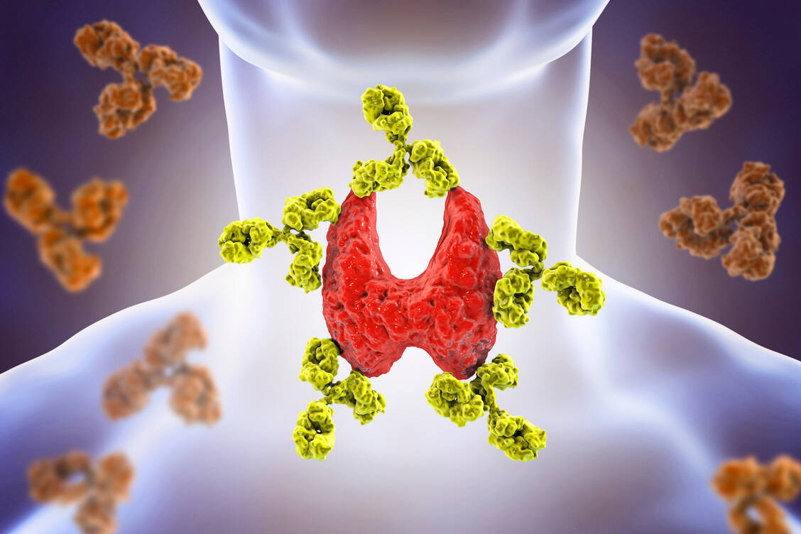 Bei der Hashimoto-Thyreoiditis greifen körpereigene Antikörper das Schilddrüsengewebe an. / Foto: Adobe Stock/Dr_Microbe