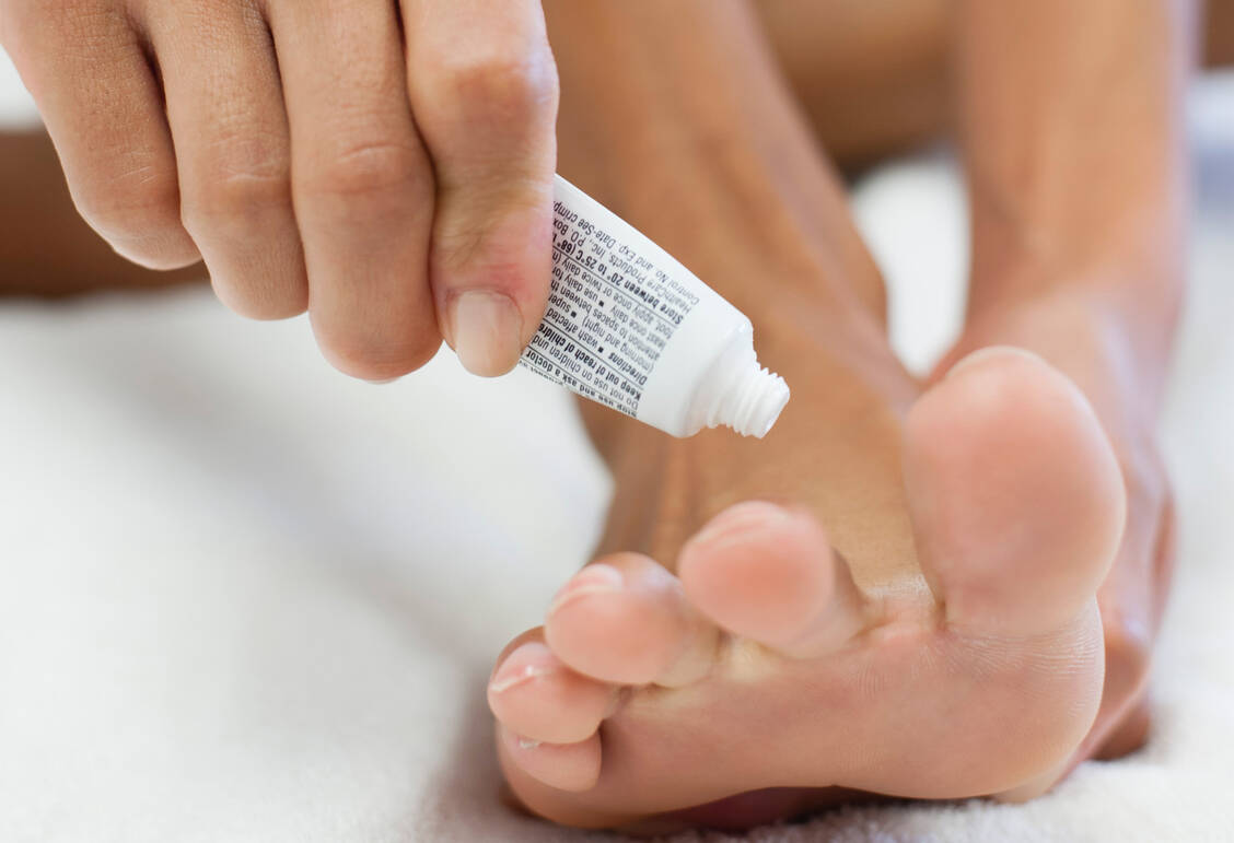 Ein fußpilz beginnt häufig zwischen den Zehen. Für die lokale Therapie stehen neben Cremes auch Sprays, Puder, Gele und Lösungen zur Verfügung. / Foto: Getty Images/PhotoAlto/Odilon Dimier