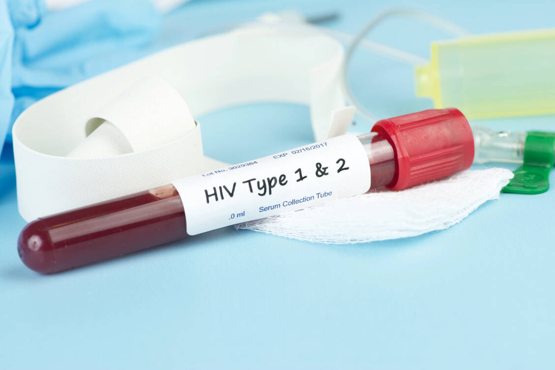 Dank wirksamer Medikamente kann eine Aids-Erkrankung heute in der Regel verhindert werden. Dafür muss eine HIV-Infektion aber frühzeitig erkannt und behandelt werden. / Foto: Fotolia/Sherry Yates Young