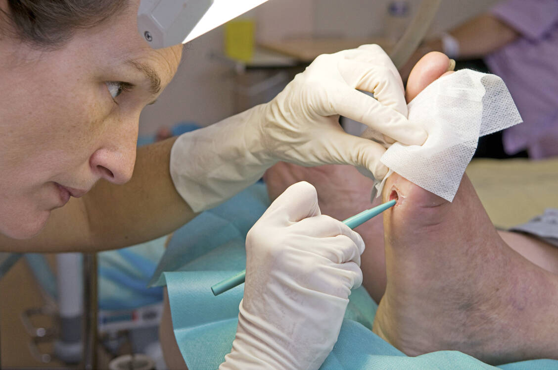 Wird ein diabetischer Fuß zu spät behandelt, steigt das Risiko für eine Amputation. / Foto: Your_Photo_Today