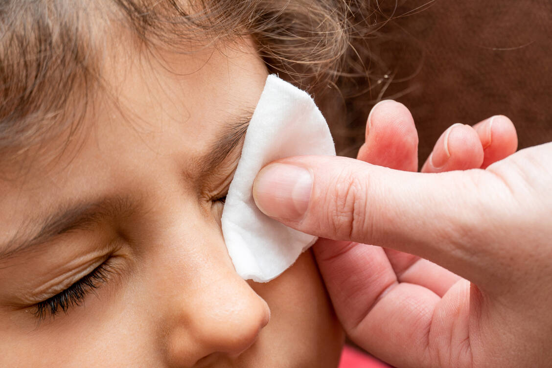 Geduldig und konsequent: Bei einer chronischen Blepharitis ist die tägliche gründliche Lidrandpflege entscheidend. / © Adobe Stock/vitalis83