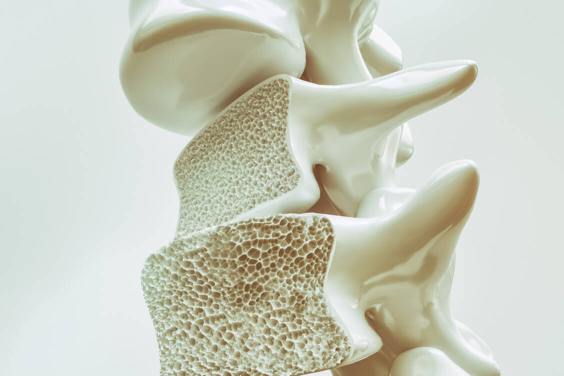 Unfortunately, because constantly too much parathyroid hormone causes the bones to lose more and more calcium. It is then no longer just the ageing process that gnaws away at the bones. / Foto: Adobe Stock/crevis