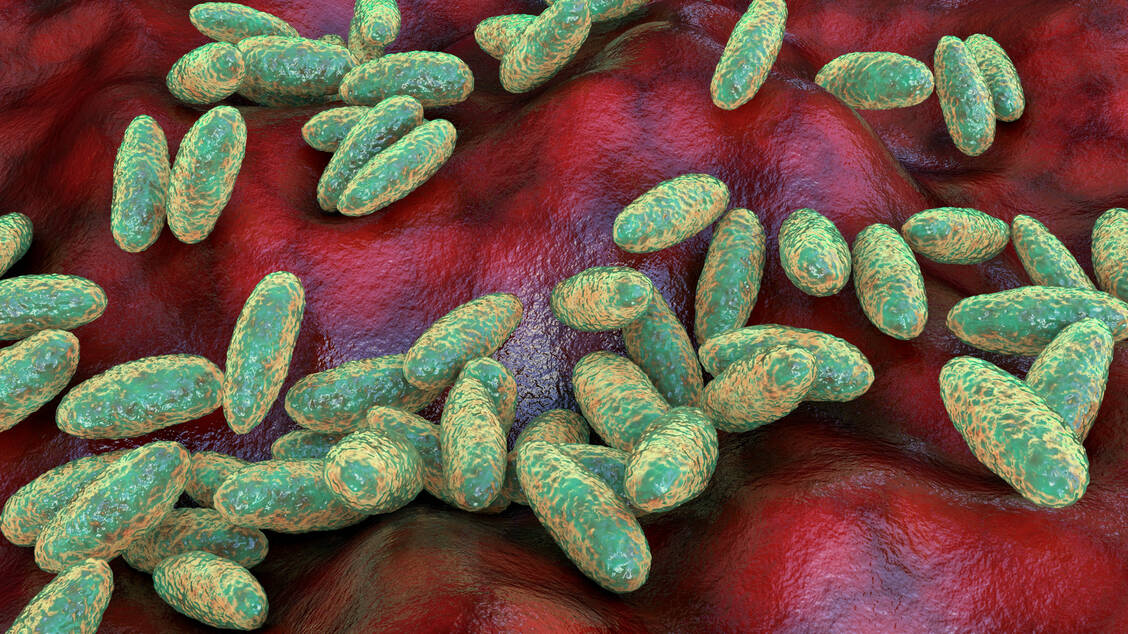 Eine Infektion der Lunge mit Yersinia pestis muss schnell behandelt werden. / © Getty Images/Dr_Microbe